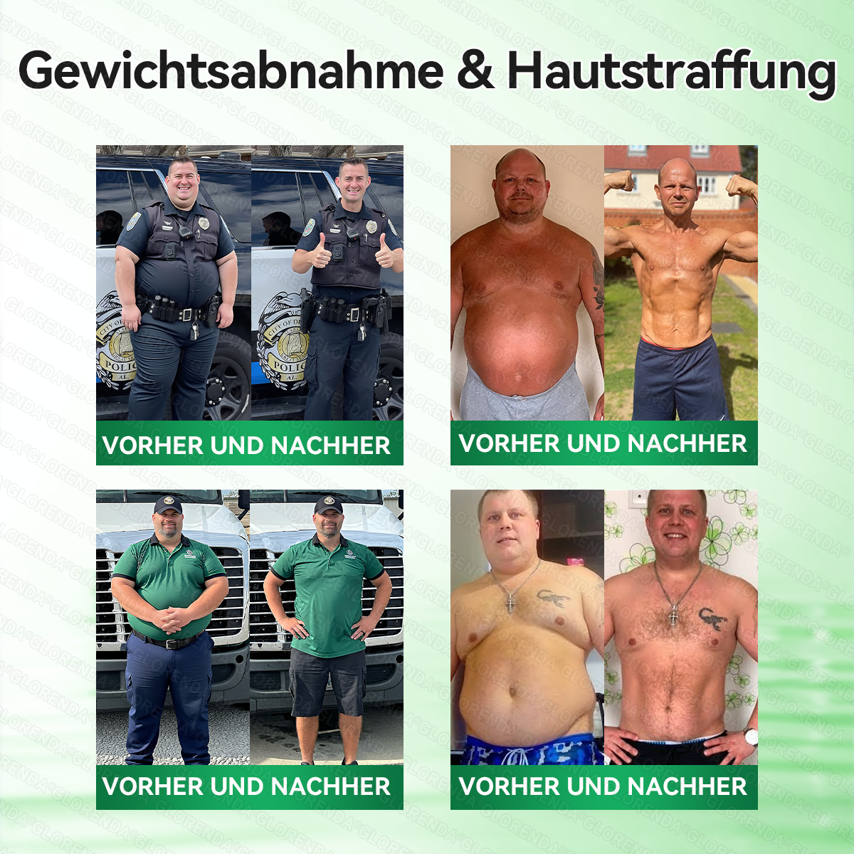 🇦🇹𝐎𝐟𝐟𝐢𝐳𝐢𝐞𝐥𝐥𝐞𝐫 𝐒𝐡𝐨𝐩 |🌍🎉𝑮𝑳𝑶𝐑𝐄𝐍𝐃𝘼®𝙈𝙤𝙧𝙞𝙣𝗴𝗮 · 𝗕𝗲𝗿𝗯𝗲𝗿𝒊𝒏 × 𝑵𝘼𝘿+ 10-𝙞𝙣-𝟏 𝐀𝐝𝐯𝐚𝗻𝗰𝗲𝗱 𝗡𝗮𝙣𝙤 𝙈𝙞𝙠𝙧𝐨𝐧𝐚𝐝𝐞𝐥-𝐏𝐚𝒕𝒄𝗵(𝐍𝐮𝐫 𝐞𝐢𝐧𝐦𝐚𝐥 𝐭ä𝐠𝐥𝐢𝐜𝐡, 𝐬𝐢𝐜𝐡𝐭𝐛𝐚𝐫𝐞 𝐕𝐞𝐫ä𝐧𝐝𝐞𝐫𝐮𝐧𝐠𝐞𝐧 𝐢𝐧 𝟕 𝐓𝐚𝐠𝐞𝐧)✅ 𝐅ü𝐫 𝐅𝐞𝐭𝐭𝐥𝐞𝐢𝐛𝐢𝐠𝐤𝐞𝐢𝐭, 𝐇𝐚𝐮𝐭𝐬𝐭𝐫𝐚𝐟𝐟𝐮𝐧𝐠, 𝐃𝐢𝐚𝐛𝐞𝐭𝐞𝐬, 𝐒𝐜𝐡𝐥𝐚𝐟𝐚𝐩𝐧𝐨𝐞, 𝐆𝐞𝐥𝐞𝐧𝐤𝐩𝐫𝐨𝐛𝐥𝐞𝐦𝐞 𝐮𝐧𝐝 𝐦𝐞𝐡𝐫!